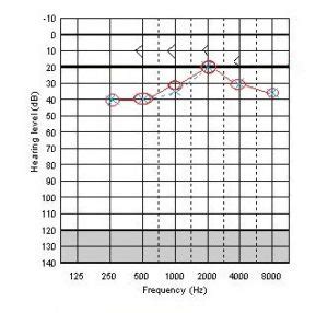 is the meps hearing test hard|online hearing loss test.